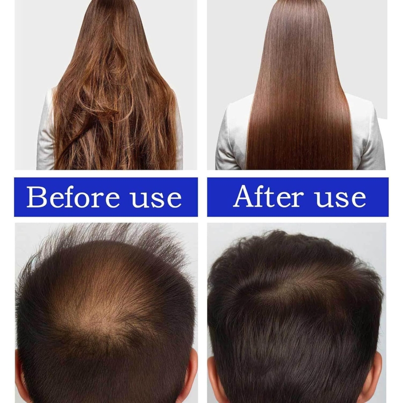 Natural Pure Batana Growth Oil Anti Break Loss Hair Growth Oil Baldness Treatment For Traction Alopecia Hair Mask